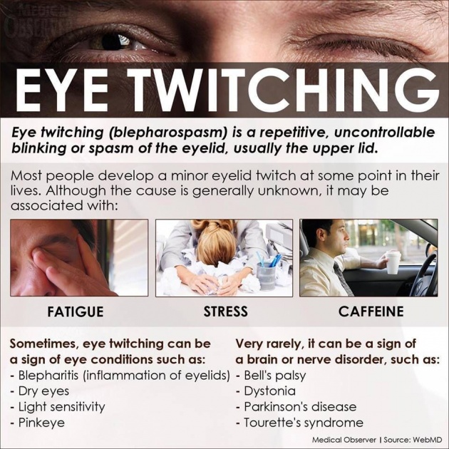 All About Eyelid Twitching Are You Familiar With This Annoying Eye