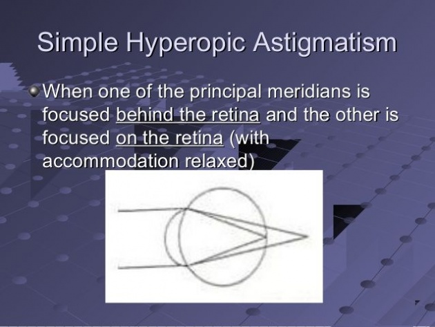 what_are_the_symptoms_of_astigmatism